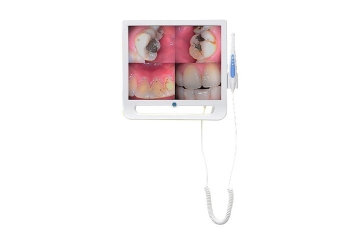 Cámara intraoral